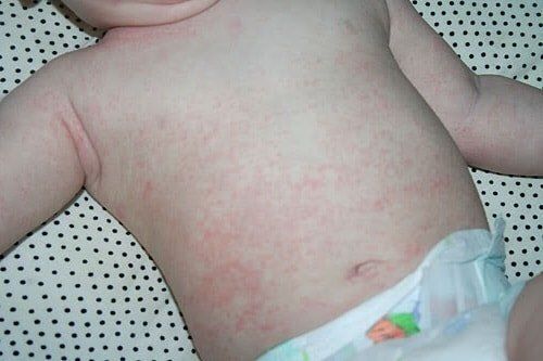 ������ ���� � �����: ����� ��� ������� ��������?